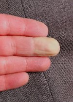 Cold-finger.jpg