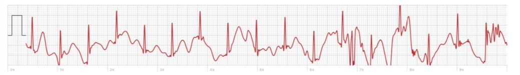 Screen Shot 2025-12-11 at Dec, 11 2025 2.13.28 PM.jpg Screen Shot 2025-12-11 at Dec, 11 2025 2.13.28 PM.jpg