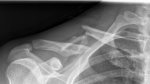 clavicle.jpg
